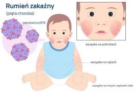 ilustracja do wpisu 
Uwaga Rodzice!